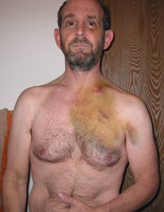I was really banged up. Scott had seen this...